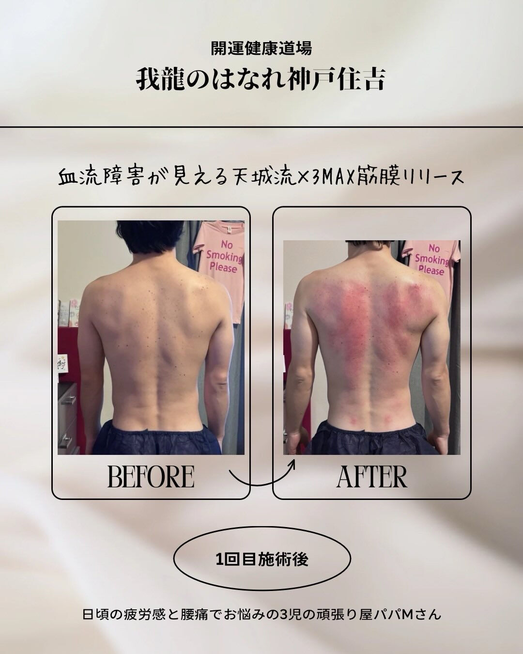 夏の痩身モニターキャンペーンを実施します